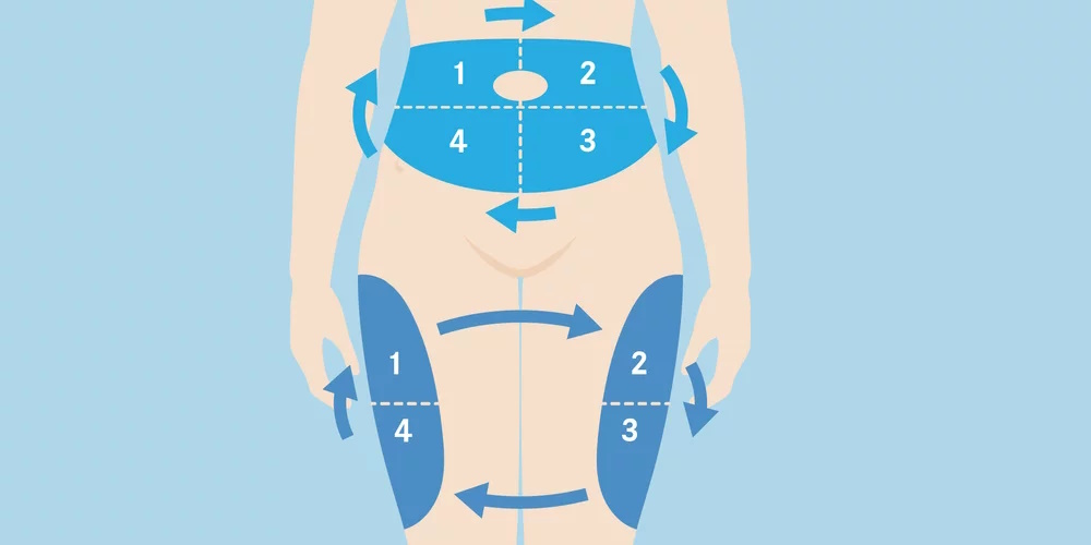 Schema Injectieplaatsen