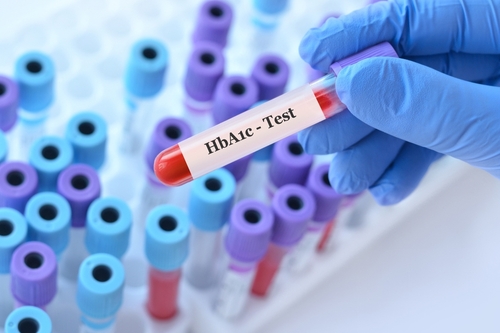 hba1c test